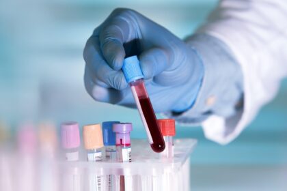 Study Suggests AI-Generated Drug Could Slow Aging