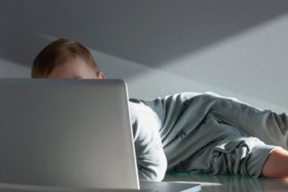 A Boy Spent 8 Hours a Day With a Laptop on His Body. He Ended Up With ‘Toasted Skin’
