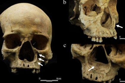 This Skeleton May Prove That Imperial China Really Did Cut Off Noses as Punishment