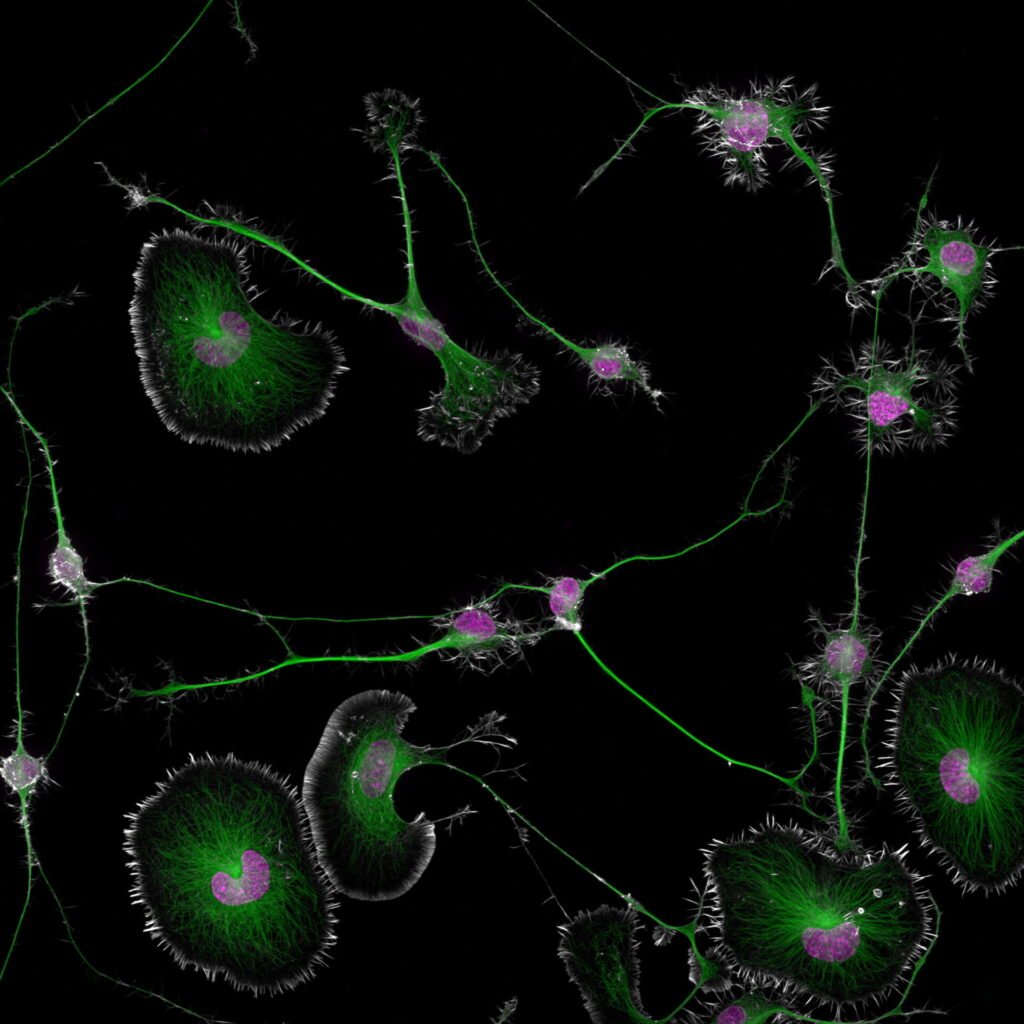 The competition-winning image was this shot of differentiated brain tumor cells from a mouse.