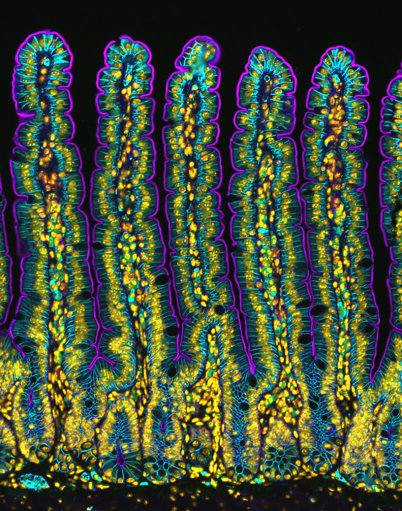 In 4th place: A view of a mouse's small intestine.