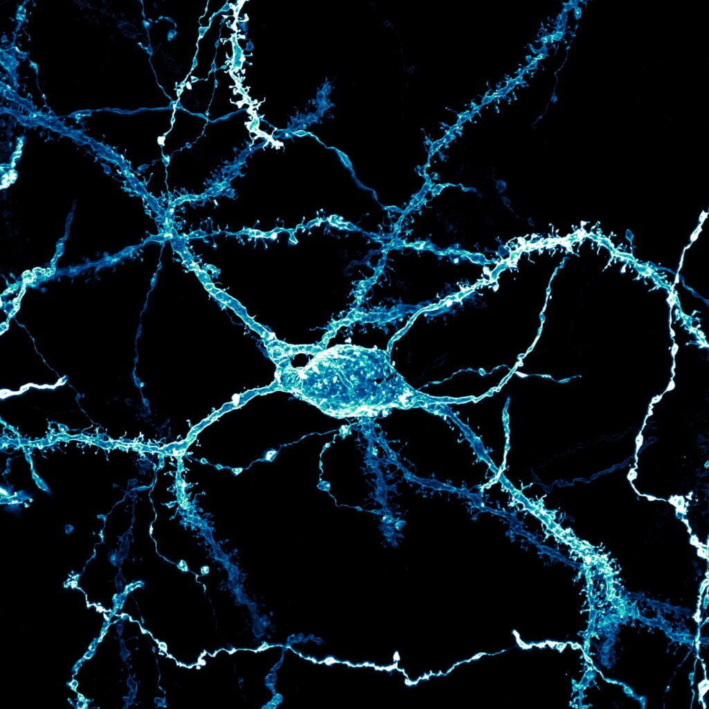 8th place was awarded to an image of a neuron from the brain of an adult rat.