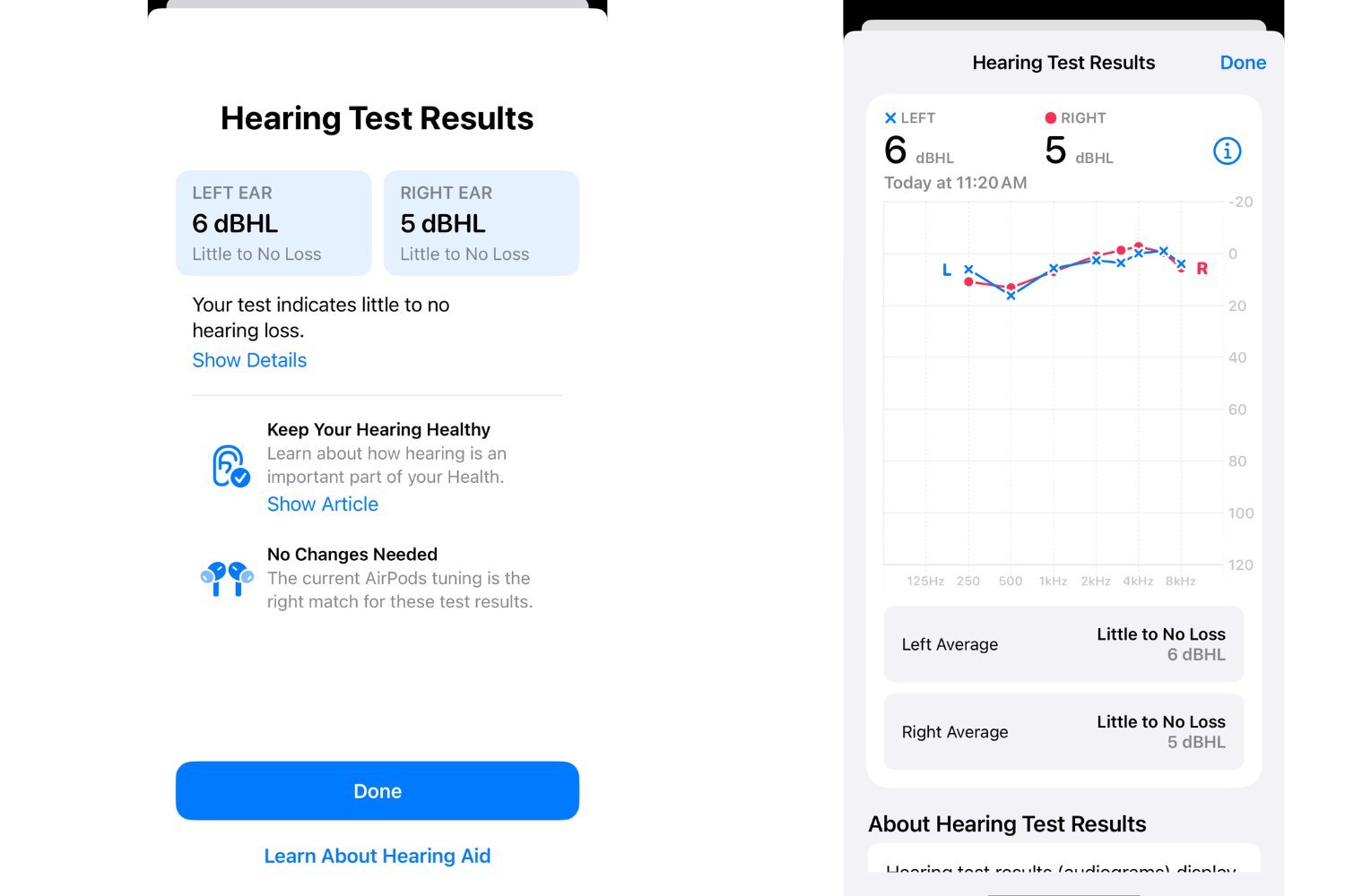 Hearing Test Results