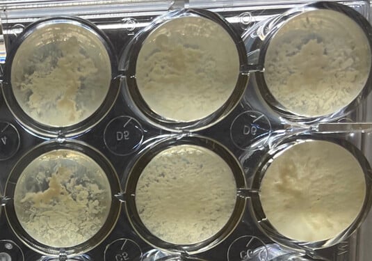 Bacterium After Dormancy