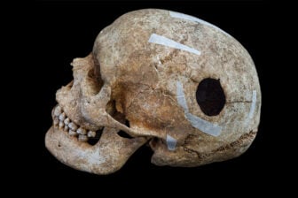 Skull With Hole